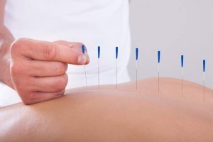 acupuncture_jpg_838x0_q67_crop-smart