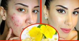 Amazing-Health-Benefits-of-Evening-Primrose-Oil-face