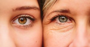 Şişkin Göz Kapaklarından ve Göz Altı Halkalarında Kurtulma Yöntemleri